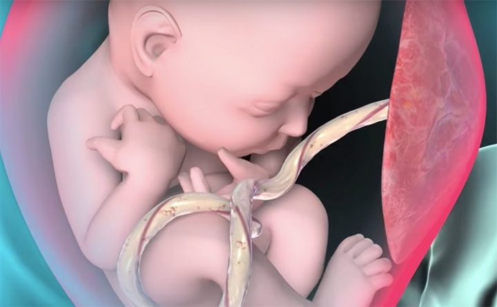 胎儿医学动画